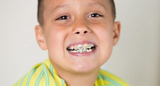 cuál es la mejor edad para ortodoncia