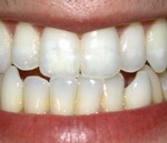 dientes y celulas madre