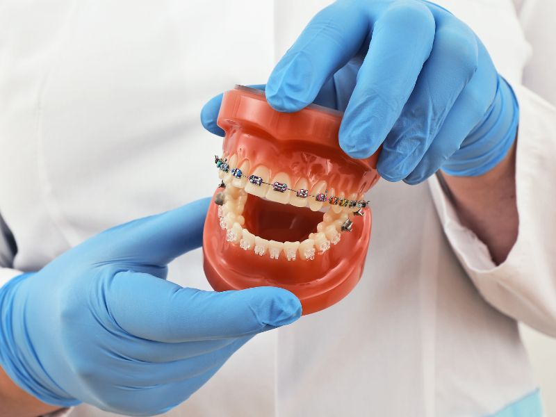 Mitos y verdades ortodoncia