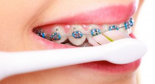 como cepillarse si tengo ortodoncia