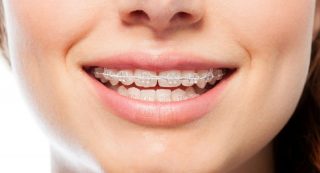 consejos ortodoncia niños