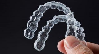 retenedores post-ortodoncia