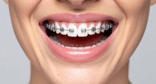 impacto de la ortodoncia en la salud bucal