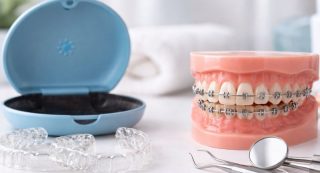 ortodoncia invisible vs tradicional